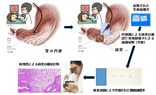 消化器科医による胃内視鏡（胃カメラ）