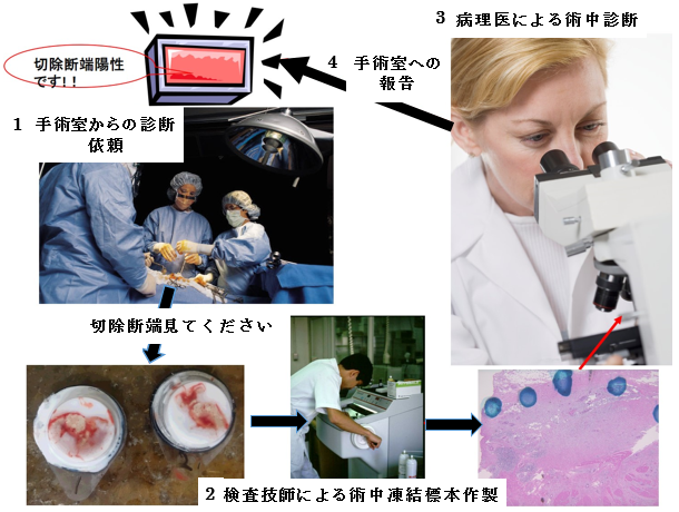 術中迅速診断
