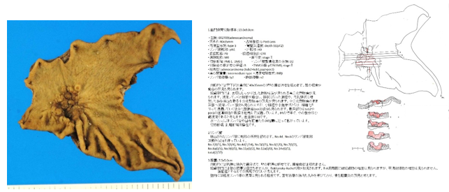 手術で摘出された臓器を用いた病理学的検討